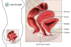 Treatment For A Leaky Bladder 2 How EM Chair treatment Billingshurst can help Leaky bladder issues. Read more now!