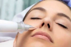 Best Actinic Keratoses Removal 3 Actinic keratoses Billingshurst solutions - book in today!