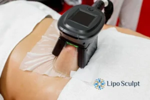 Does Fat Freezing At Home Work? 3 Fat freezing at home from Lipo Sculpt Billingshurst